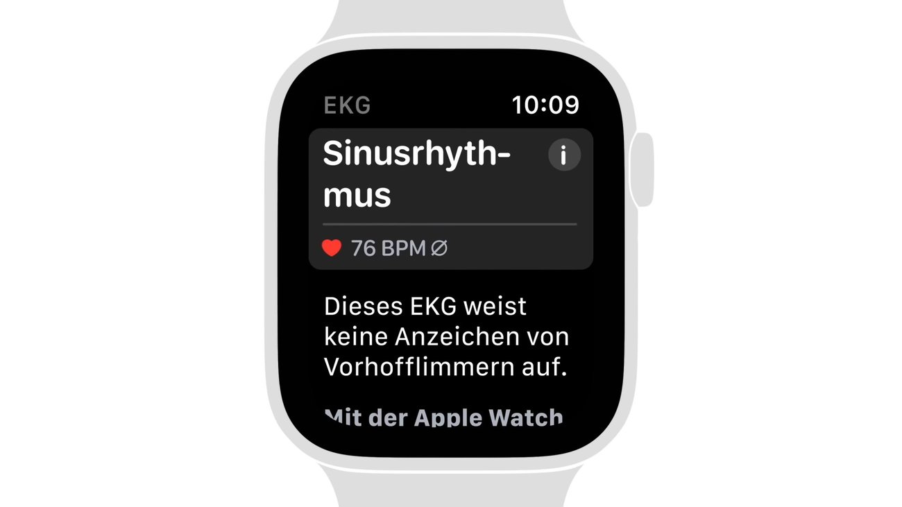 Apple-Video: So erstellst du ein EKG auf der Apple Watch Series 4
