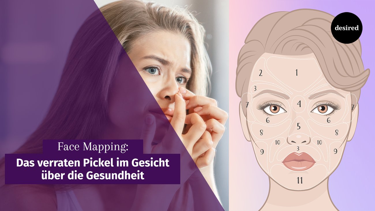 Face Mapping: Das verraten Pickel im Gesicht über die Gesundheit