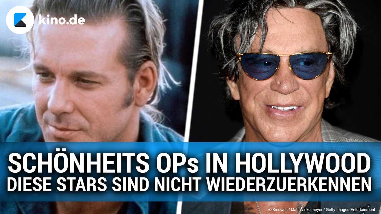 Schönheits-OPs in Hollywood