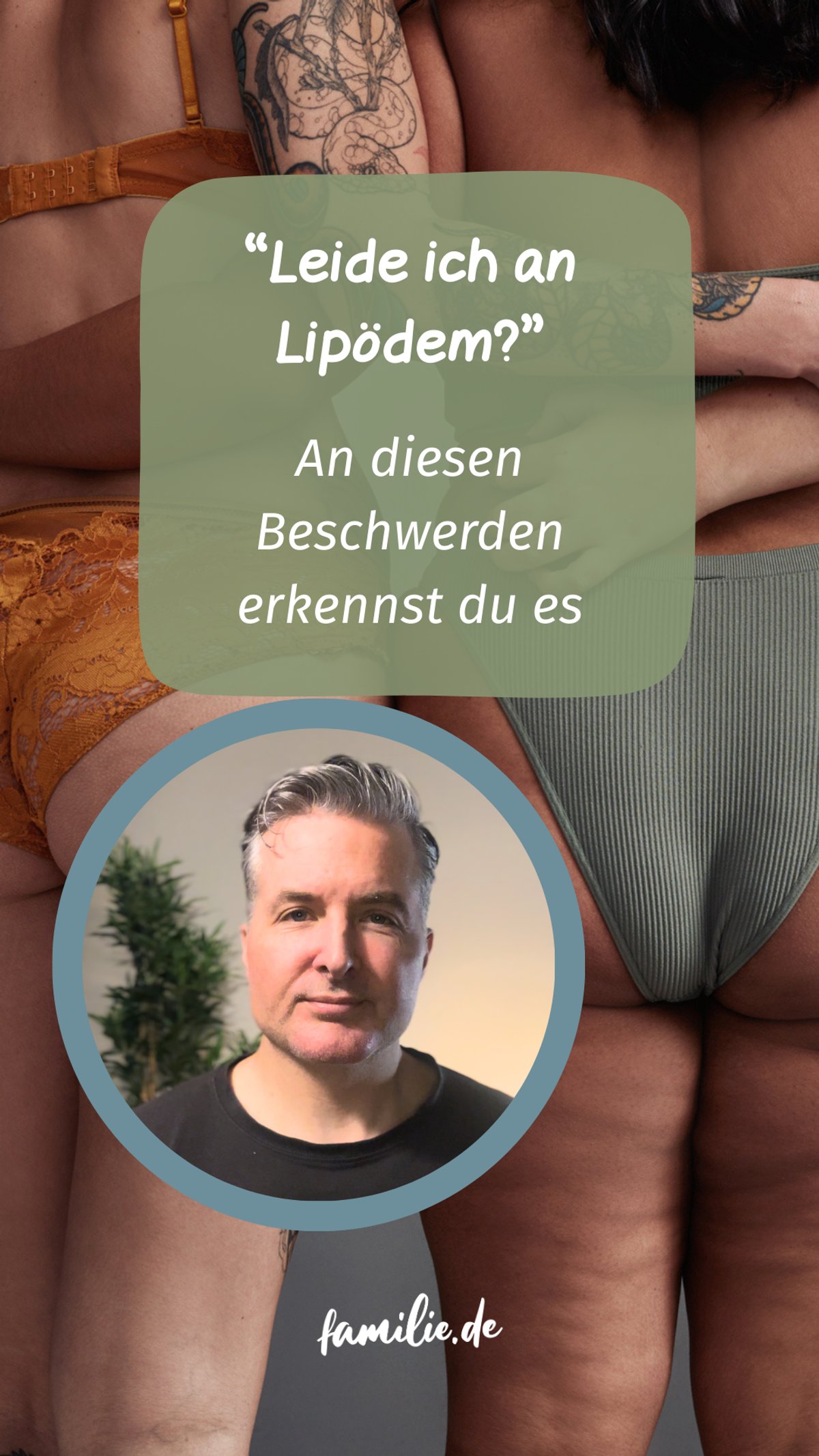 Leide ich an Lipödem? Dr. Christian Schmitz klärt auf Leide ich an Lipödem? Dr. Christian Schmitz klärt auf